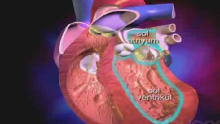 Sol Ventrikül Destek Cihazı (Vdc)