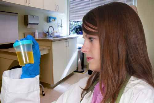 Mikroalbumin Testi