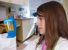 Mikroalbumin Testi Mikroalbumin Testi
