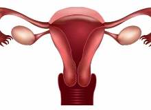 Myomektomi Myomektomi