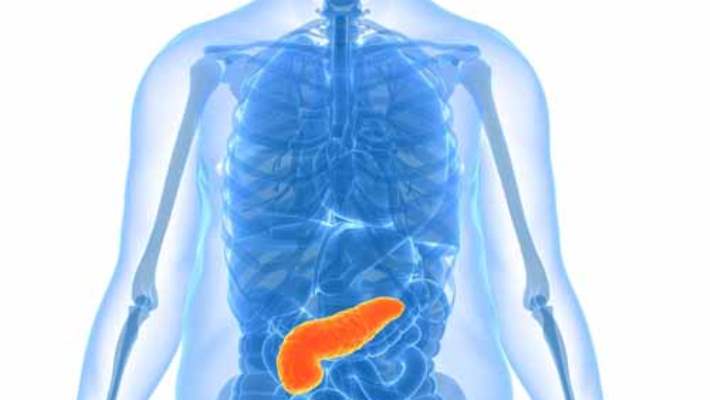 Pankreas Nakli Nedir?