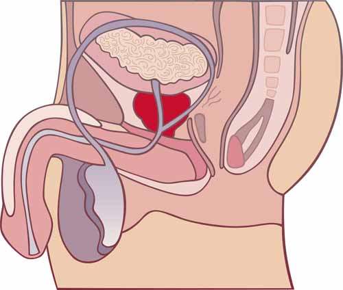 Prostat Biyopsisi