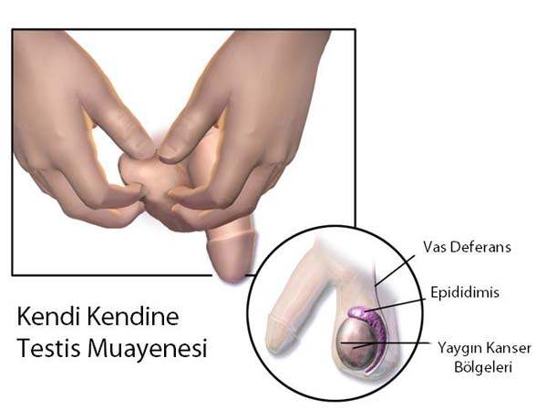Testis Muayenesi