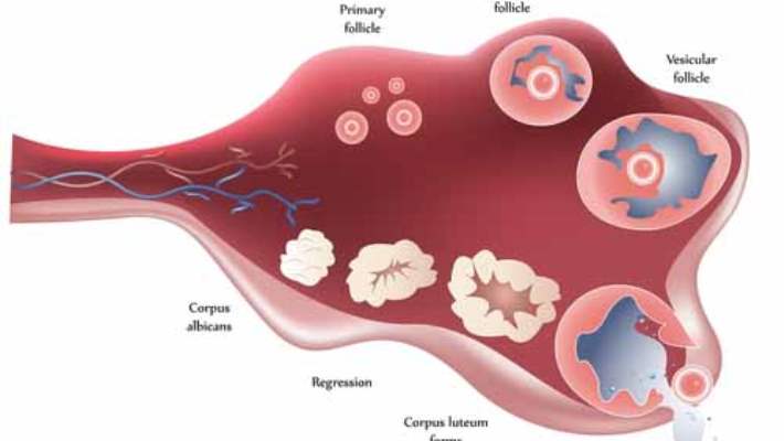 Vajinal Histerektomi