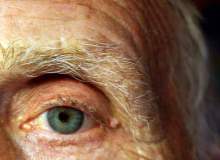 Diyabetik Göz Hastalığı (Retinopati) Diyabetik Göz Hastalığı (Retinopati)