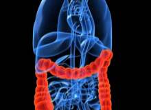 Divertikülit Divertikülit