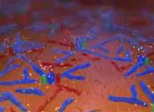 Akut Karaciğer Yetmezliği Akut Karaciğer Yetmezliği