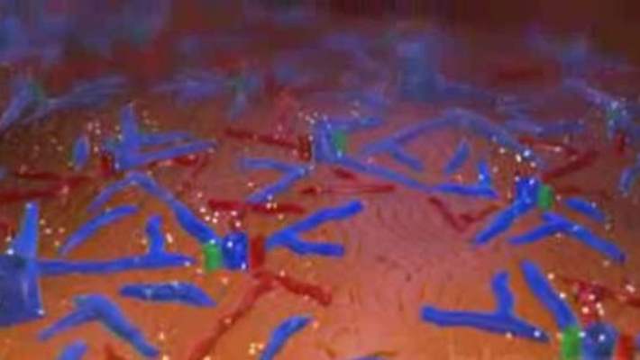 Akut Karaciğer Yetmezliği