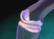 Kırık Parmak Kırık Parmak