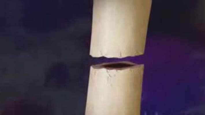 Stres (Gerilim) Kırıkları