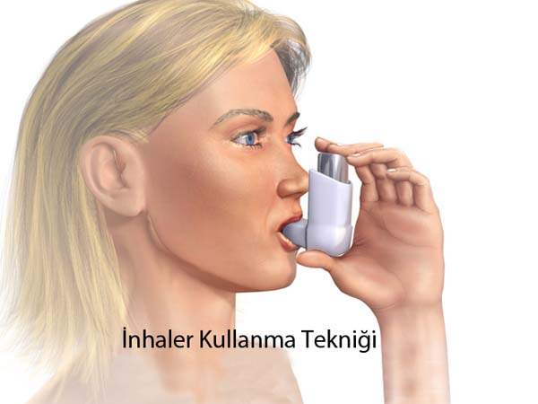 Ağzın Kusurlu Kapanması