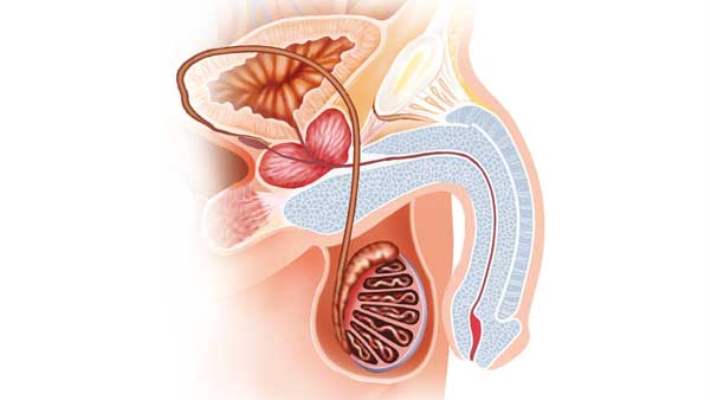 peyronie hastaligi hemen saglik