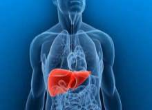 Toksik Hepatit Toksik Hepatit