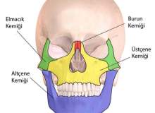 Trigeminal Nevralji (Yüz Sinir Ağrısı) Trigeminal Nevralji (Yüz Sinir Ağrısı)