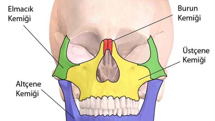 Trigeminal Nevralji (Yüz Sinir Ağrısı)