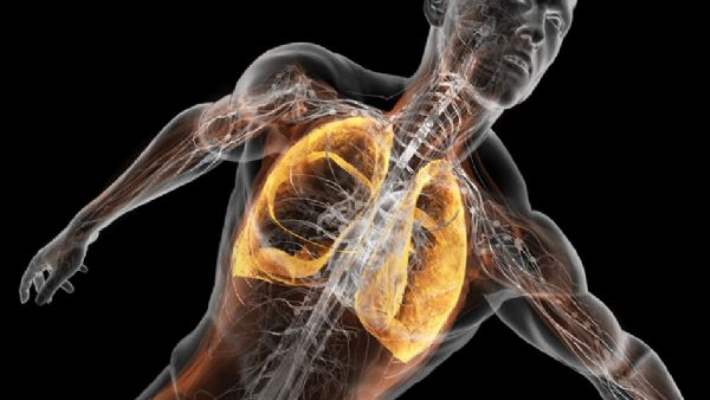 Akciğerin Sönmesi (Pnömotoraks)