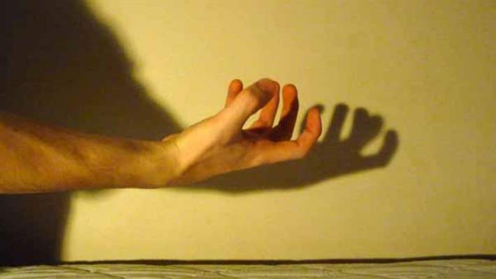 Artrit İçin Alternatif Tedaviler