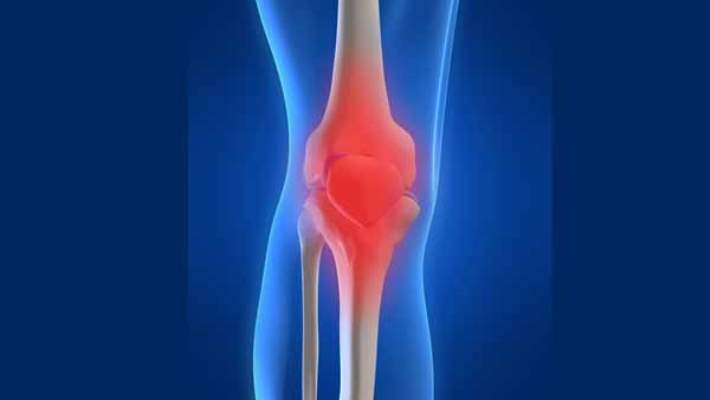 Romatoid Artritin Nedenleri