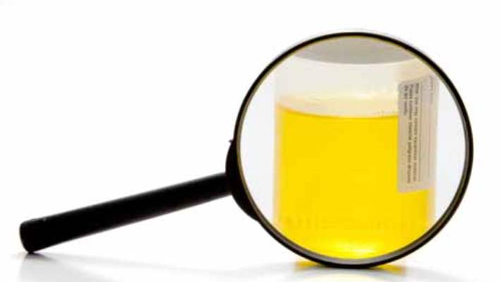 İdrar Yolları İltihabı