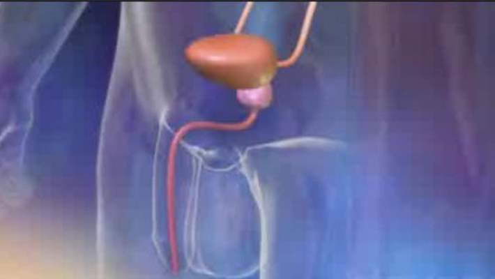 idrar kacirma hemen saglik