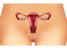 Polikistik Over (Yumurtalık) Sendromu (PKO) Polikistik Over (Yumurtalık) Sendromu (PKO)