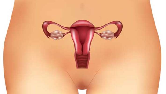 Polikistik Over (Yumurtalık) Sendromu (Pko)