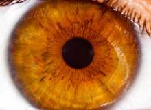 Kornea Aşınması Kornea Aşınması