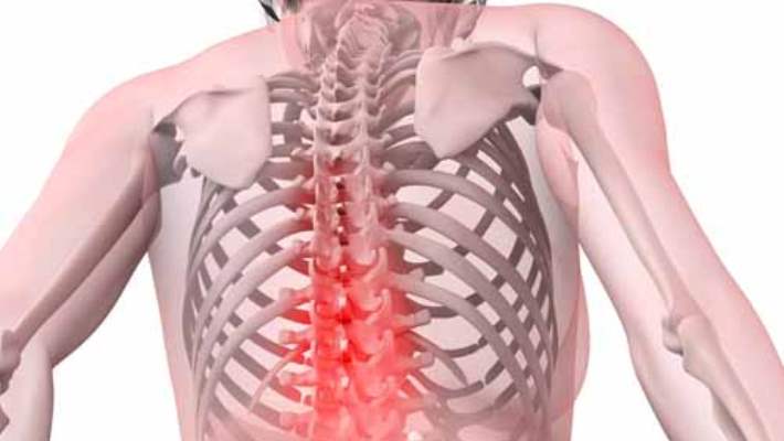 sirt ameliyati hemen saglik