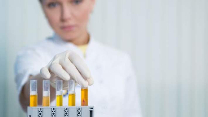 İdrarda Protein Çıkması