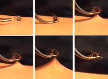 Bir Kene Nasıl Çıkarılır? Bir Kene Nasıl Çıkarılır?