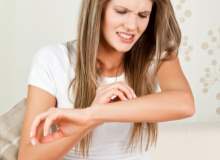 Deri Kaşıntısı (Prurit) Deri Kaşıntısı (Prurit)