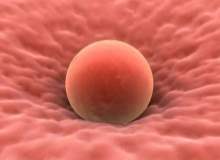 Essure Sistemi Essure Sistemi