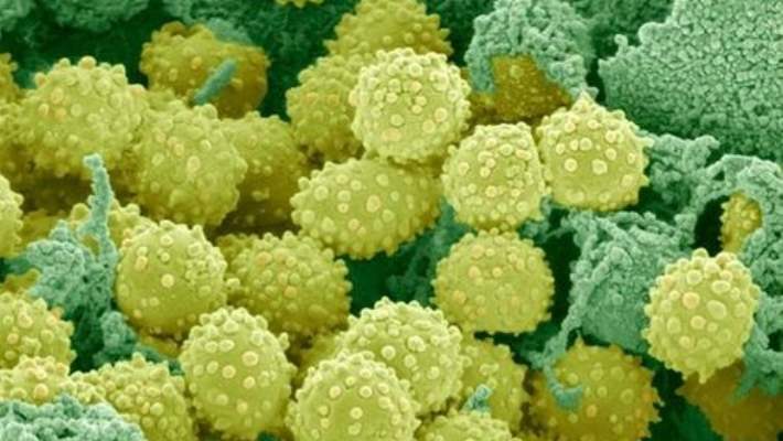 Şarbon (Şirpençe)