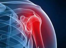 Omuz Ayrılması Omuz Ayrılması