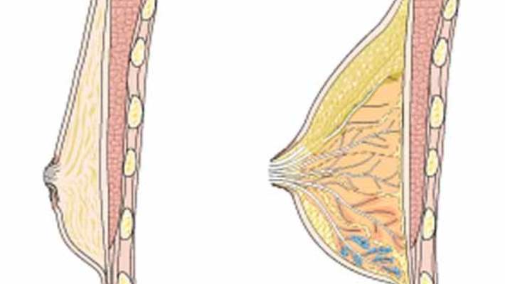 erkeklerde gogus kanseri hemen saglik