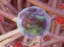 Rahim (Endometrial) Kanseri Rahim (Endometrial) Kanseri