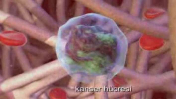 Rahim (Endometrial) Kanseri