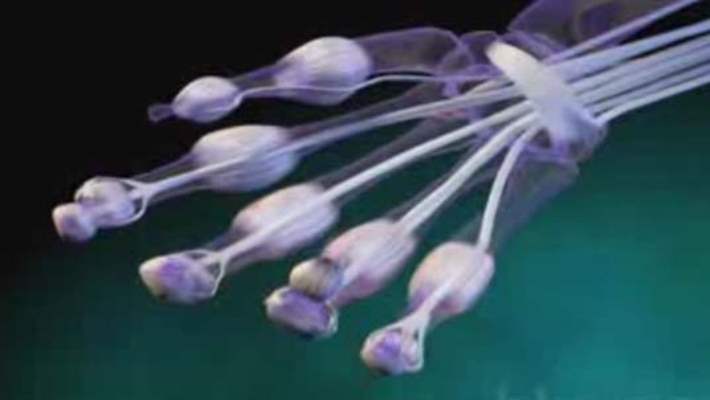 Osteokondritis Dissekans