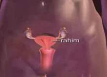 Rahim Yırtılması Rahim Yırtılması