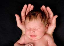 Seboreik Dermatit Seboreik Dermatit