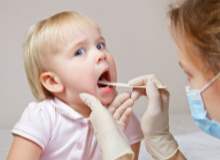 Streptokok Boğaz Ağrısı Streptokok Boğaz Ağrısı