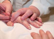 Ganglion Kisti Ganglion Kisti