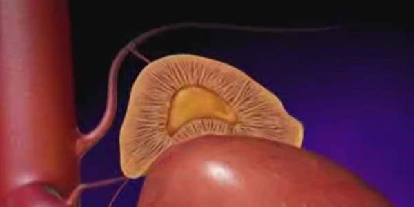 Konjenital (Doğuştan) Adrenal Hiperplazi