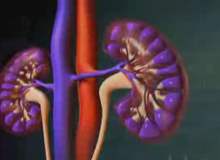 İgA nefropatisi (Berger hastalığı) İgA nefropatisi (Berger hastalığı)