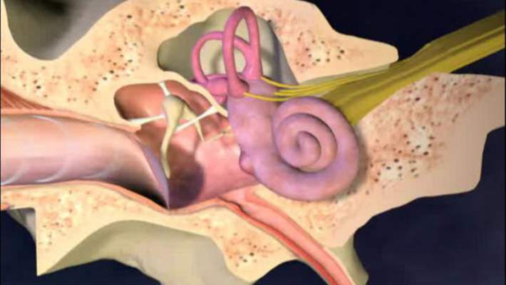 Efüzyonlu Orta Kulak İltihabı