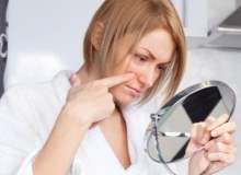 Pilonidal Kist Pilonidal Kist