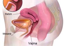 Vajinal Atrofi Vajinal Atrofi