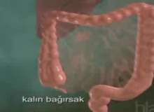 Hirschsprung Hastalığı Hirschsprung Hastalığı
