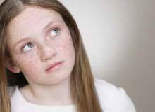 Klippel-Trenaunay-Weber Sendromu (KTW) Klippel-Trenaunay-Weber Sendromu (KTW)