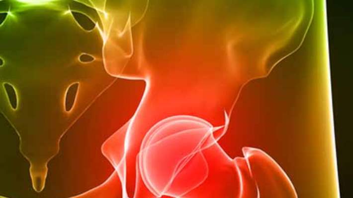 Doğuştan Kalça Çıkığı (Dkç)